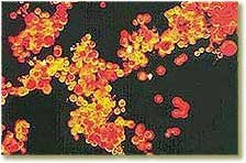 astaxanthin from Haematococcus pluvialis